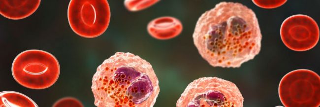 ¿Qué es el lupus? Enfermedad por la que falleció la esposa de Beltrones