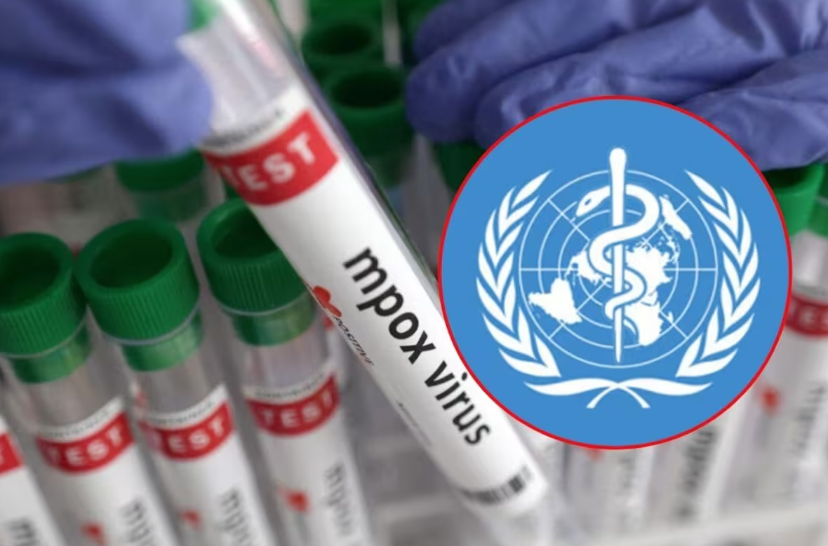 OMS mantiene alerta mundial por aumento de casos de Mpox