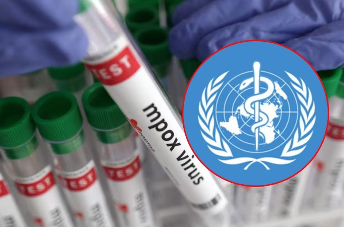 OMS mantiene alerta mundial por aumento de casos de Mpox OMS mantiene alerta mundial por aumento de casos de Mpox